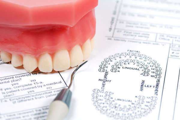 Lawsuit for Dental Malpractice